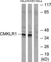 ChemR23 Polyclonal Antibody