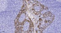ChemR23 Polyclonal Antibody