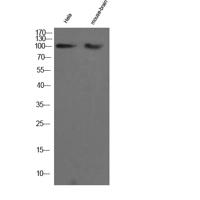 CHERP Polyclonal Antibody