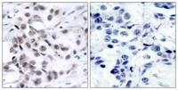 Chk1 Polyclonal Antibody