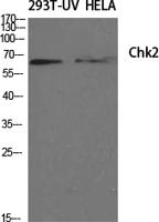 Chk2 Polyclonal Antibody
