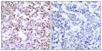 Chk2 Polyclonal Antibody