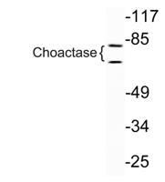 Choactase Polyclonal Antibody