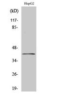 ChoKB Polyclonal Antibody