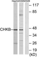 ChoKB Polyclonal Antibody