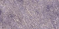 ChoKB Polyclonal Antibody