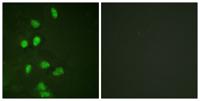 CHOP Polyclonal Antibody