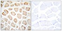 CHOP Polyclonal Antibody