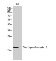 Choriogonadotropin β Polyclonal Antibody