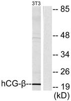 Choriogonadotropin β Polyclonal Antibody