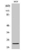 CHP2 Polyclonal Antibody