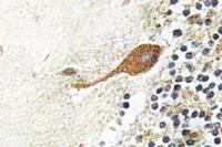 Chr-A Polyclonal Antibody