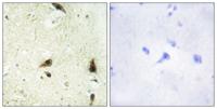 CHRAC15 Polyclonal Antibody
