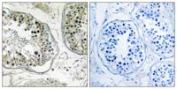 CHST13 Polyclonal Antibody