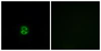 CHST6 Polyclonal Antibody