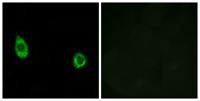 CHST9 Polyclonal Antibody