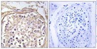 CHST9 Polyclonal Antibody