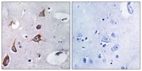 CHSY1 Polyclonal Antibody