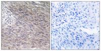 CHSY2 Polyclonal Antibody