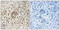 CIB2 Polyclonal Antibody