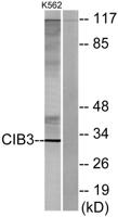 CIB3 Polyclonal Antibody