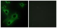 CIDE-3 Polyclonal Antibody