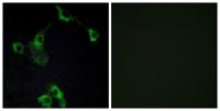 CIDE-B Polyclonal Antibody