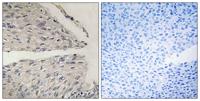 CIDE-B Polyclonal Antibody