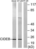 CIDE-B Polyclonal Antibody
