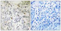 CIP29 Polyclonal Antibody