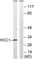 CIP29 Polyclonal Antibody