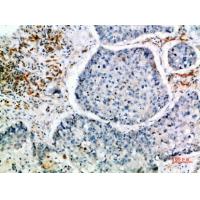 CIS Polyclonal Antibody