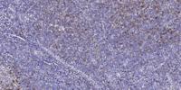 c-Kit Polyclonal Antibody