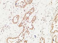 c-Kit Polyclonal Antibody