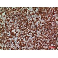 CKR-3 Polyclonal Antibody