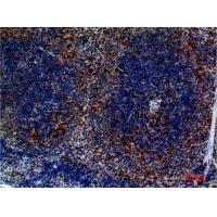 CKR-4 Polyclonal Antibody