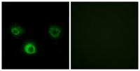 CKR-4 Polyclonal Antibody