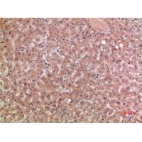 CKR-5 Polyclonal Antibody