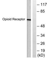 CKR-5 Polyclonal Antibody