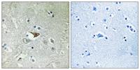 CKR-5 Polyclonal Antibody