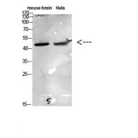 CKR-6 Polyclonal Antibody