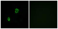CKR-7 Polyclonal Antibody