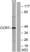 CKR-7 Polyclonal Antibody