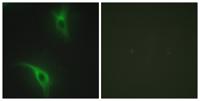 Cks1 Polyclonal Antibody