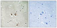 Cks2 Polyclonal Antibody