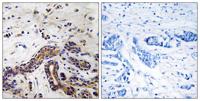 CLASP1 Polyclonal Antibody