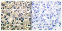 Claudin-1 Polyclonal Antibody