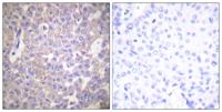 Claudin-2 Polyclonal Antibody