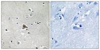 Claudin-4 Polyclonal Antibody