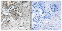 Claudin-7 Polyclonal Antibody